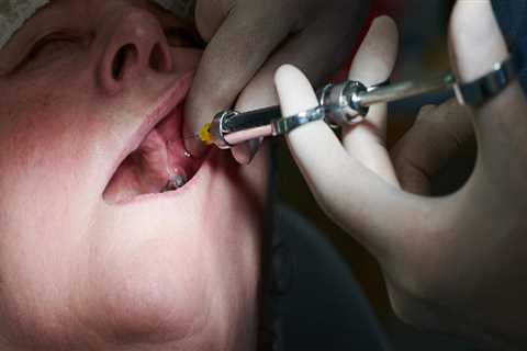 How Basel Residents Maintain Oral Health: Dental Hygiene Tips And Dental Laser Cleaning Insights