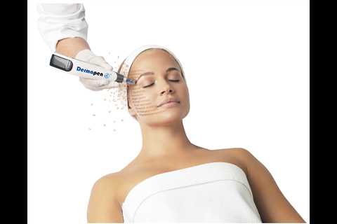At-Home vs Professional Microneedling: Pros, Cons & Is It Worth The Risk? - The DailyMoss