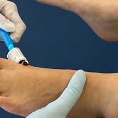 Diabetic Wound Care · Sunday, Sep 14 📸