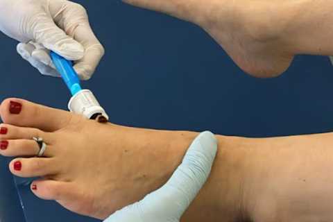 Diabetic Wound Care · Sunday, Sep 14 📸
