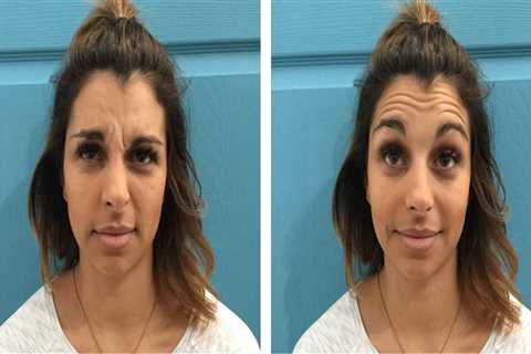 The Ultimate Guide To BOTOX In Scottsdale Medical Spas: What You Need To Know Before Your..