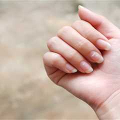 Unveiling the Mystery Behind White Spots on Nails: A Health Indicator