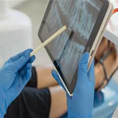 When to Consider Tooth Extraction and What to Expect in Meridian, ID