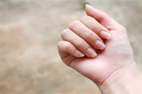 Unveiling the Mystery Behind White Spots on Nails: A Health Indicator