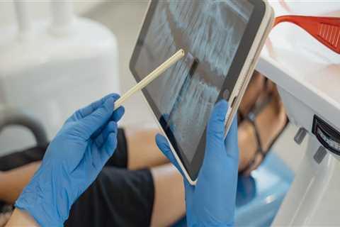 When to Consider Tooth Extraction and What to Expect in Meridian, ID