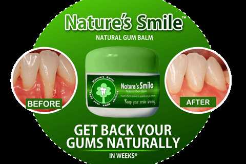 Natures Smile Reviews: What People Ate Saying About This Natural Gum-Support Formula