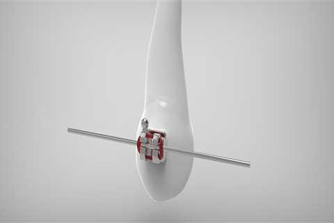 From Dental X-Rays to Braces: A Smarter Path to a Straighter Smile in Sacramento, CA