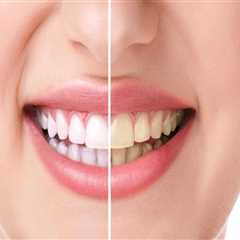 Elevate Your Oral Health with Radiant Dentistry