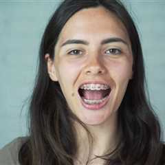 Tips for Managing Braces Discomfort as an Adult