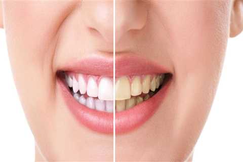 Elevate Your Oral Health with Radiant Dentistry
