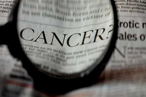 How Dental Laser Cleaning Highlights the Importance of Early Melanoma Cancer Treatment in Lake..