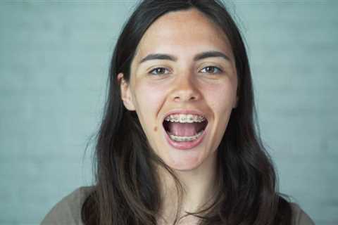 Tips for Managing Braces Discomfort as an Adult