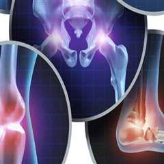 Effective Lifestyle Changes for Managing Arthritis Symptoms