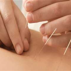 Discover the Benefits of Acupuncture for Sleeplessness in Portland