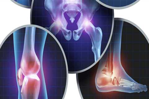 Effective Lifestyle Changes for Managing Arthritis Symptoms
