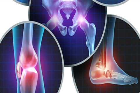 Exploring Surgical Options for Severe Arthritis: A Comprehensive Look at Arthritis Therapy