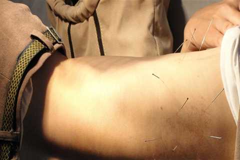 Understanding Medical Aesthetics and Acupuncture for Energy Balance