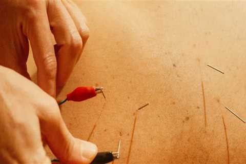 Electroacupuncture for Mental Health in Portland