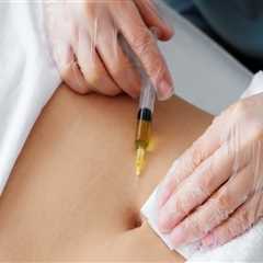 Arthritis Therapy and Expert Lipo Surgeons in Danville