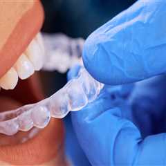 Why Refinement Stages Are More Common Than Many Invisalign Patients Expect
